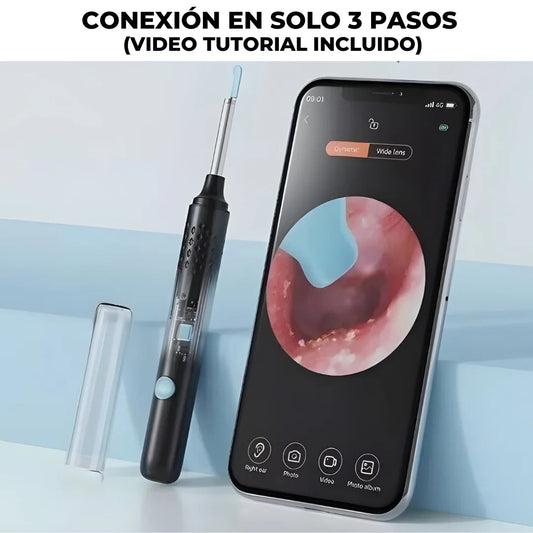 Limpieza de oídos inteligente con tecnología avanzada – WaxClean™